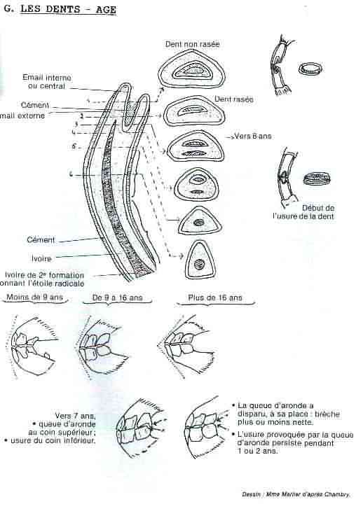 usure des dents et composition